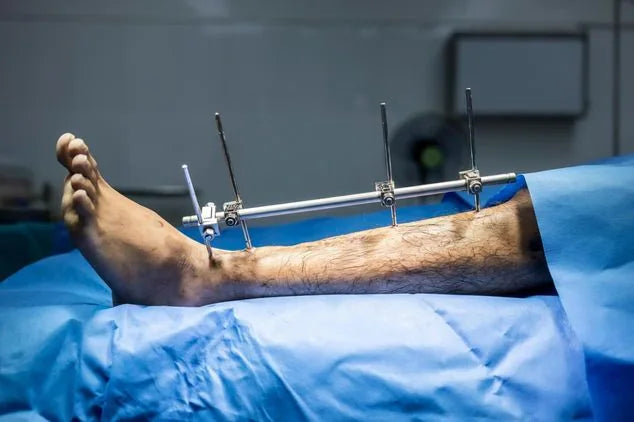 Musculoskeletal-Orthopedics &amp; Spine